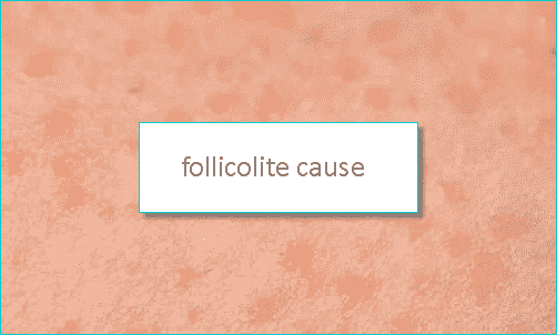 follicolite cause