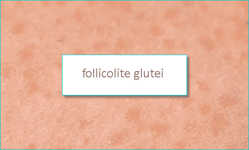 FOLLICOLITE glutei
