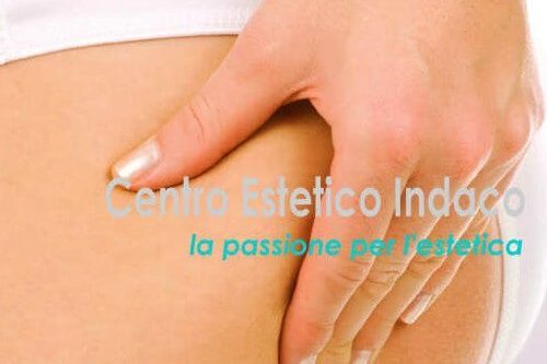 ANTICELLULITE Roma