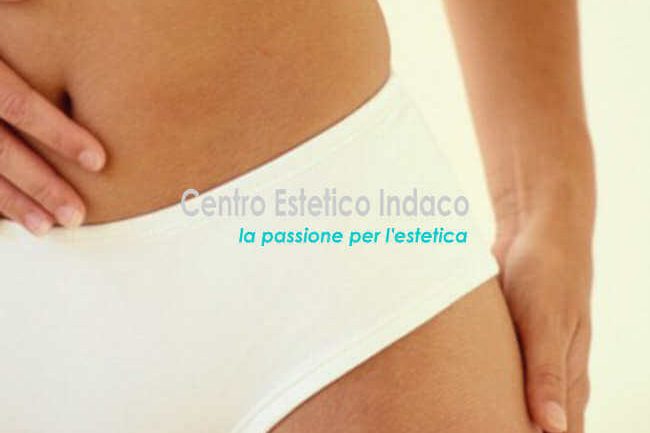 eliminare-le-smagliature