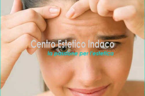 PELLE GRASSA SEBORROICA