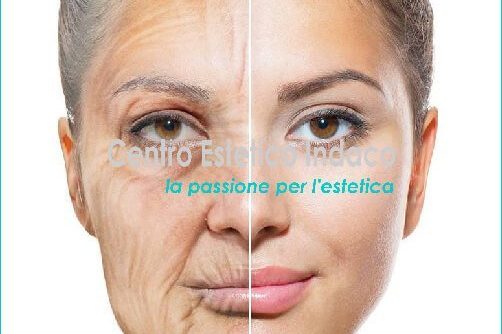 invecchiamento pelle le cause