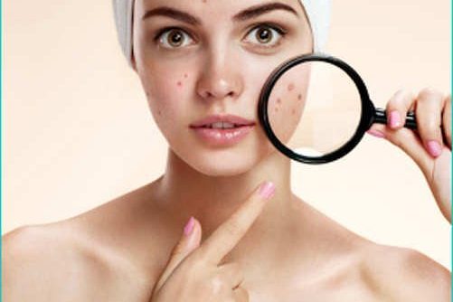 macchie rosse sul viso