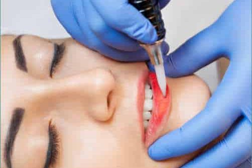 Trucco Permanente Labbra