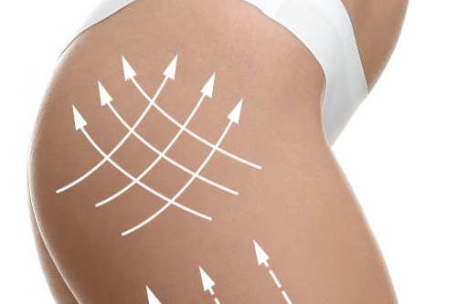 COMBATTERE LA CELLULITE