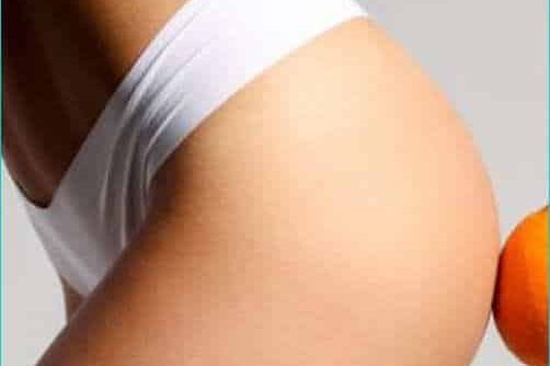 cellulite rimedi efficaci