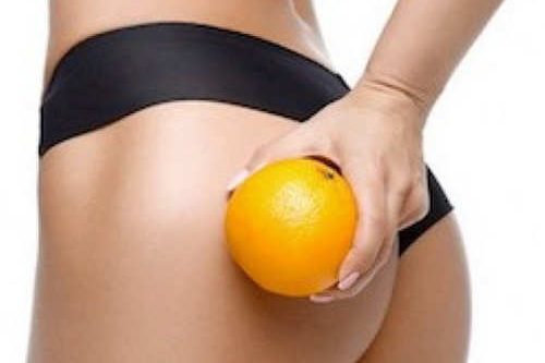 sconfiggere la cellulite